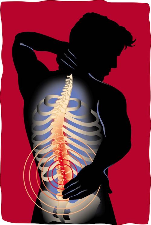Back Pain can be reduced naturally and prevented!