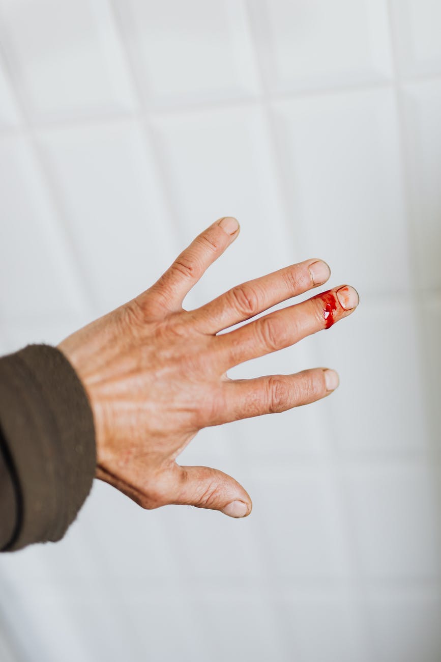 crop person with bleeding wound on finger