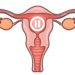 female uterus and ovaries in menopause