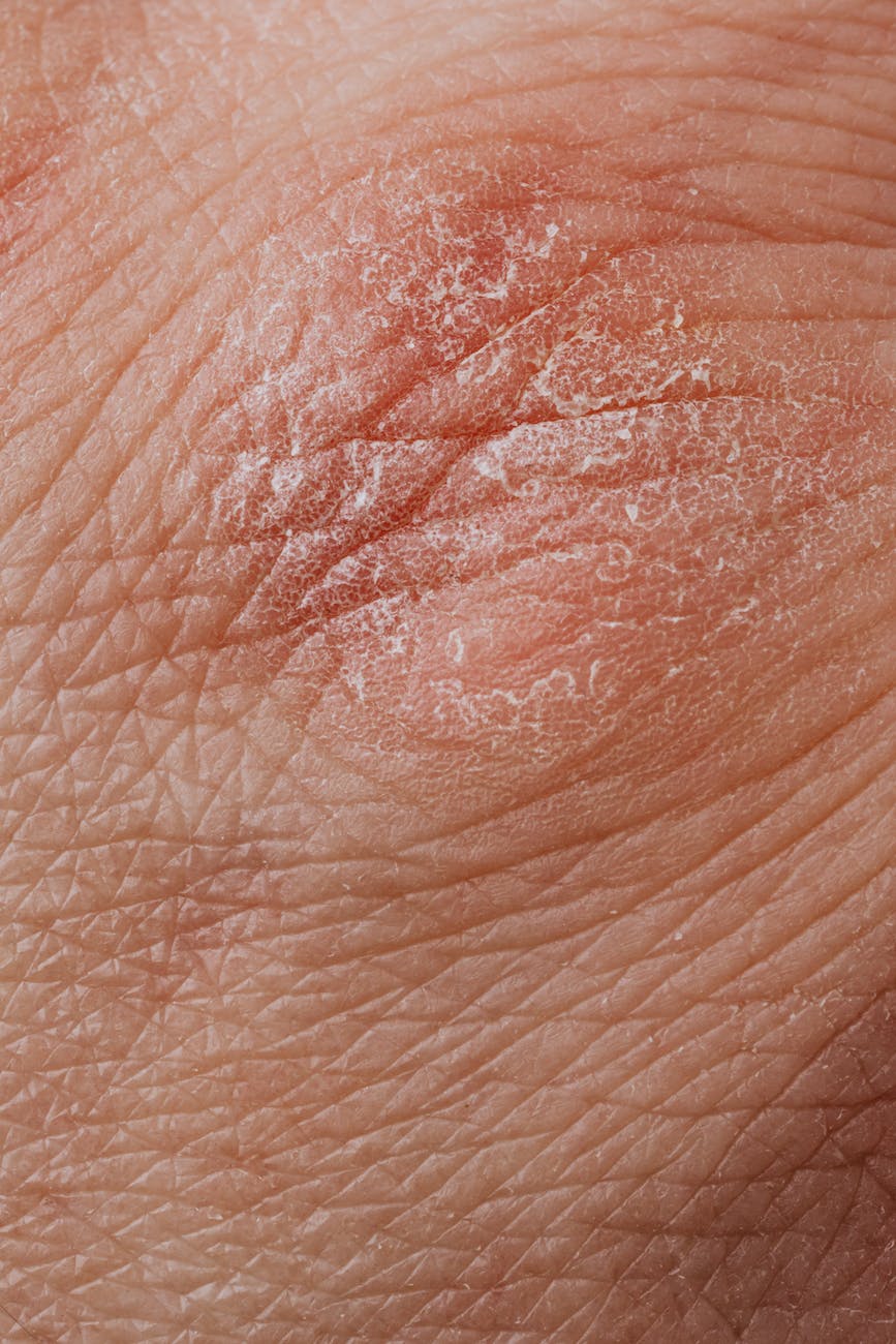 close up view of human dry skin